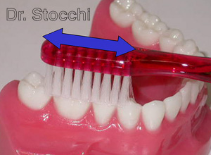 Studio dr. Marco Stocchi, spazzolino sulla superficie occlusale di premolari e molari